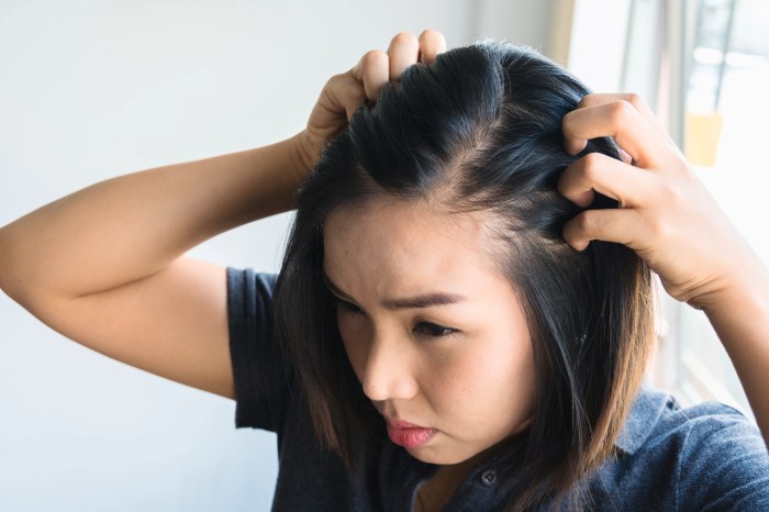 Cara Mengatasi Rambut Lepek