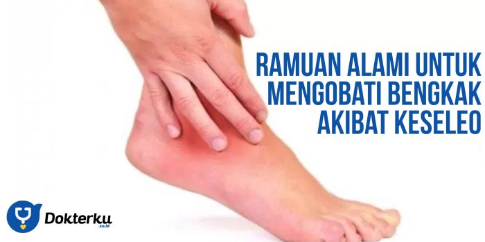 Cara Mengatasi Kaki Keseleo