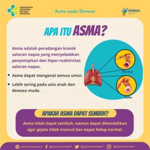 Cara Mengatasi Asma Kambuh