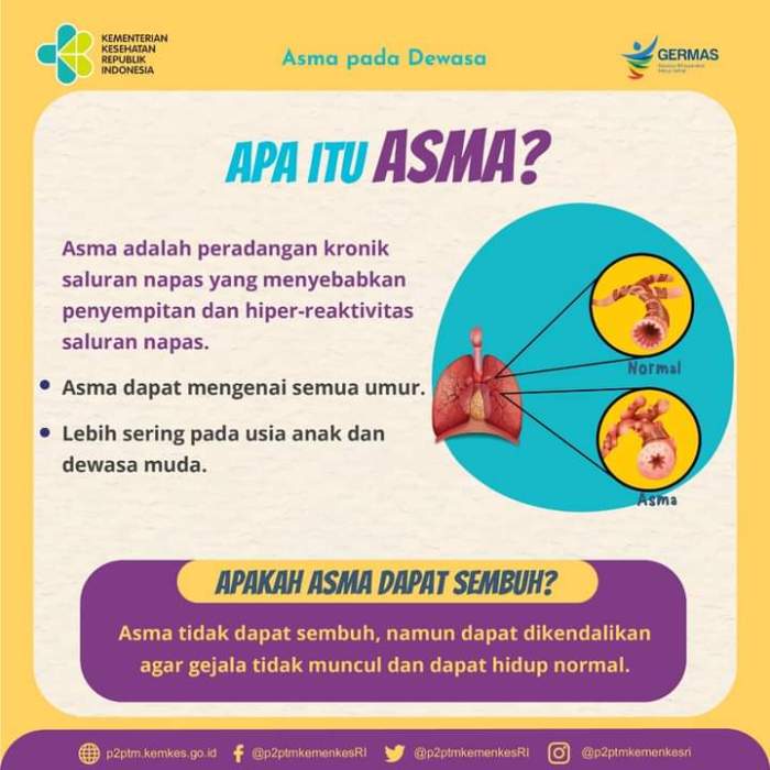 Cara Mengatasi Asma Kambuh