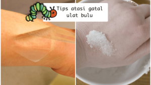 Gatal badan bentol sebab penyakit inilah ternyata penyebab alami