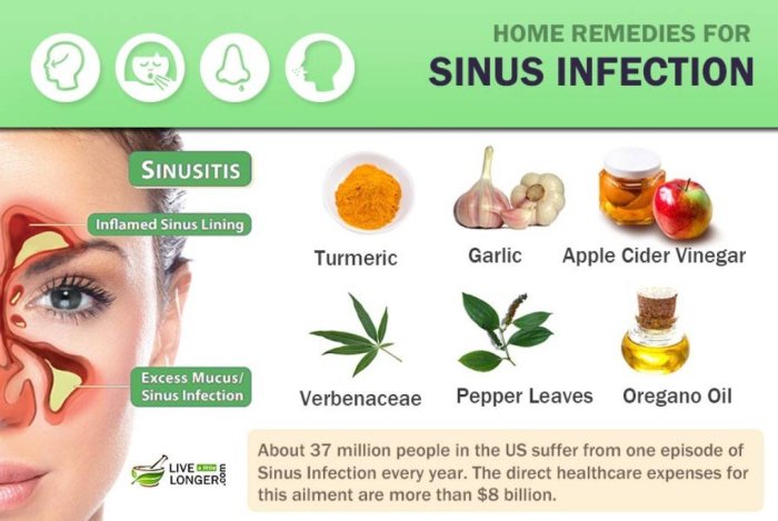 Cara Mengatasi Sinusitis